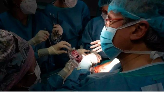 News Photo 2 - Europe - Otta Nottathil - transplated_uterus_baby_born_spain